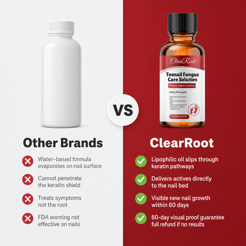 ClearRoot Toenail Fungus Care Solution